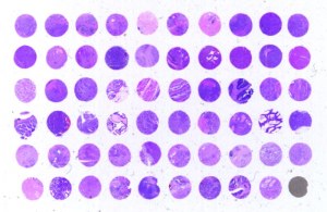 Antibody validation in IHC on TMA