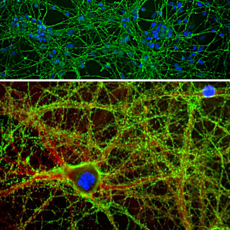 Immunofluorescence