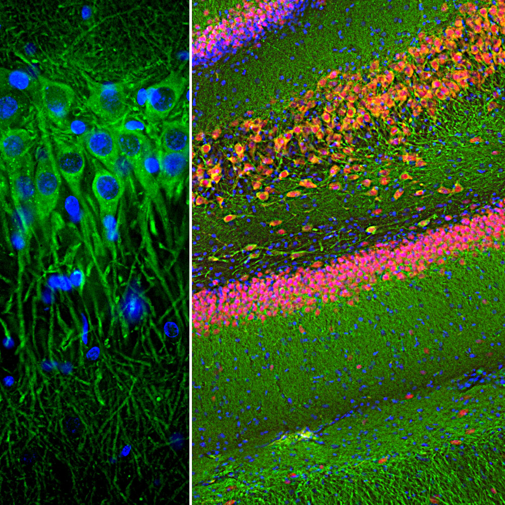 Immunofluorescence