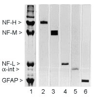 Rat spinal cord homogenate showing the major intermediate filament proteins of the nervous system (lane 1). The remaining lanes show blots of this material stainted with various antibodies including NF-L.