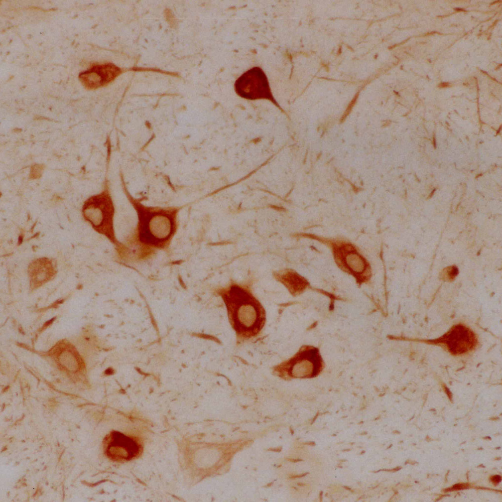 Immunohistochemistry